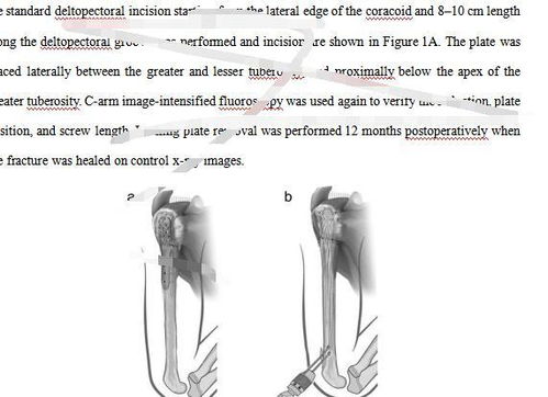 代写代发 一条龙 地下 论文工厂 是咋运作的